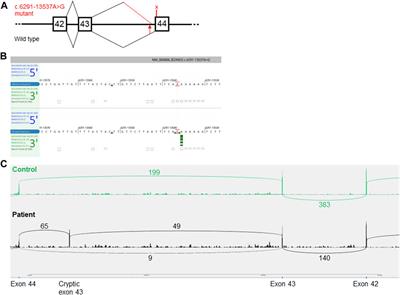 Frontiers Case Report A Novel Deep Intronic Splice Altering Variant